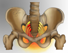 neuralgia