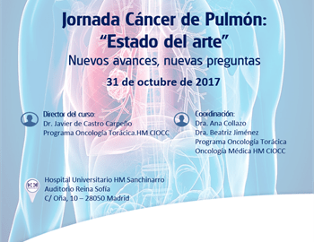 jornada cáncer pulmón