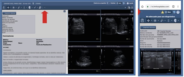 imprimir pruebas radiología