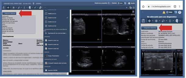 imprimir informe radiología