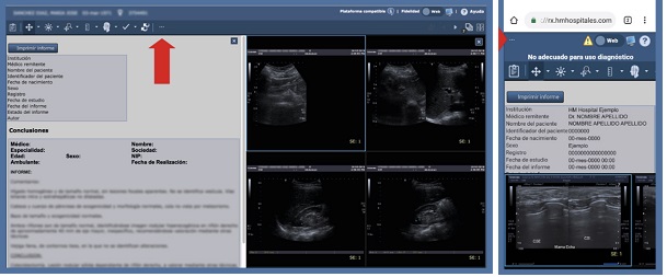 compartir estudio radiología