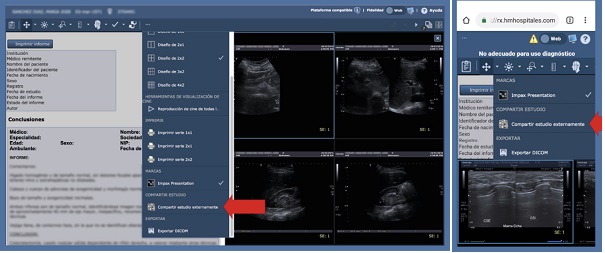 compartir estudio radiológico con su médico