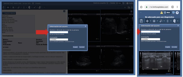 enviar por email prueba radiología