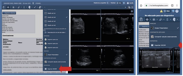 exportar dicom radiología